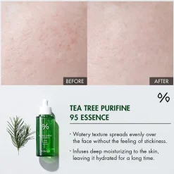 Tea Tree Purifine 95 Essence